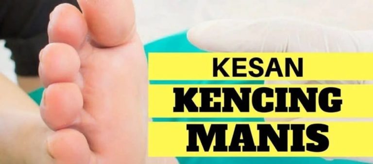 Kesan Kencing manis